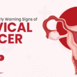 Cervical cancer : सर्वाइकल कैंसर क्यों है इतना खतरनाक औरतों के लिए